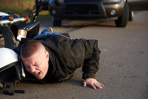 Common Motorcycle Accident Injuries: Road To Recovery